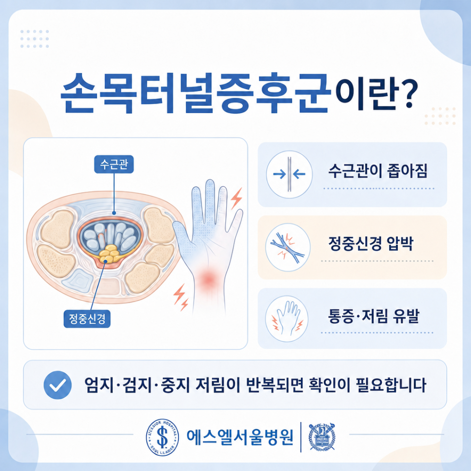 손목터널증후군 관련 이미지 2