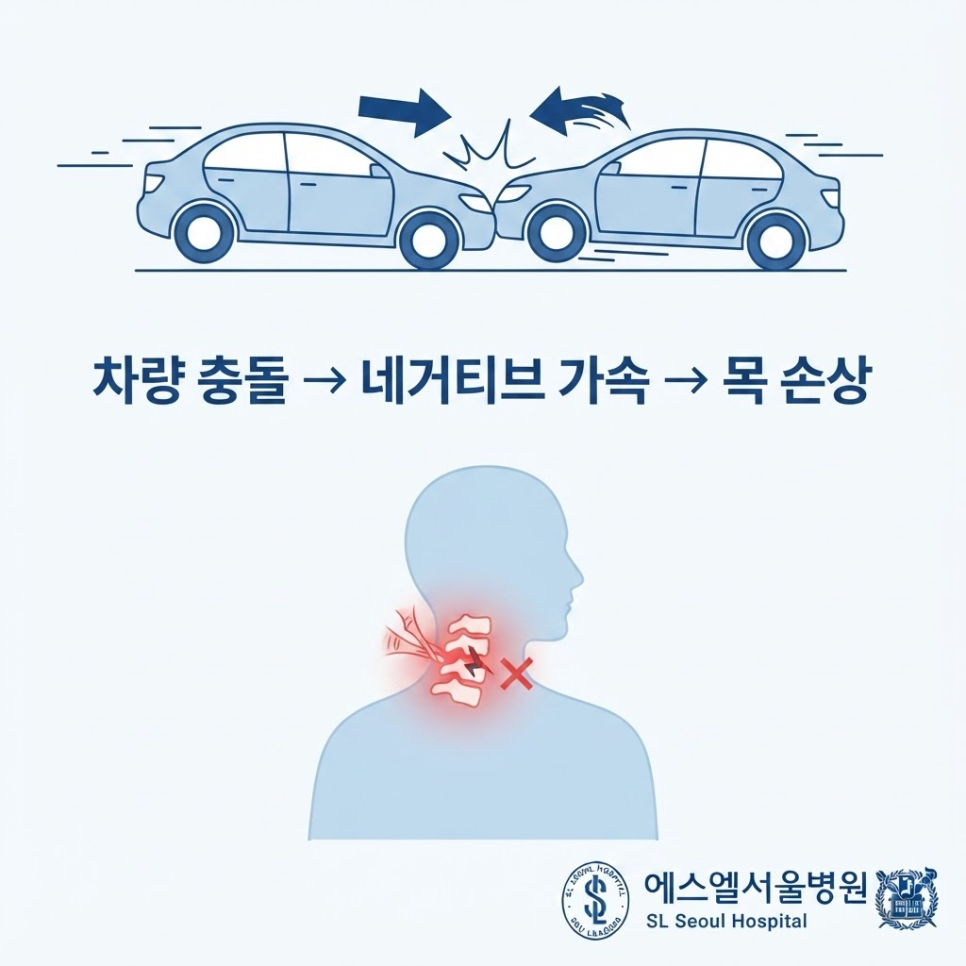 교통사고후유증 관련 이미지 3