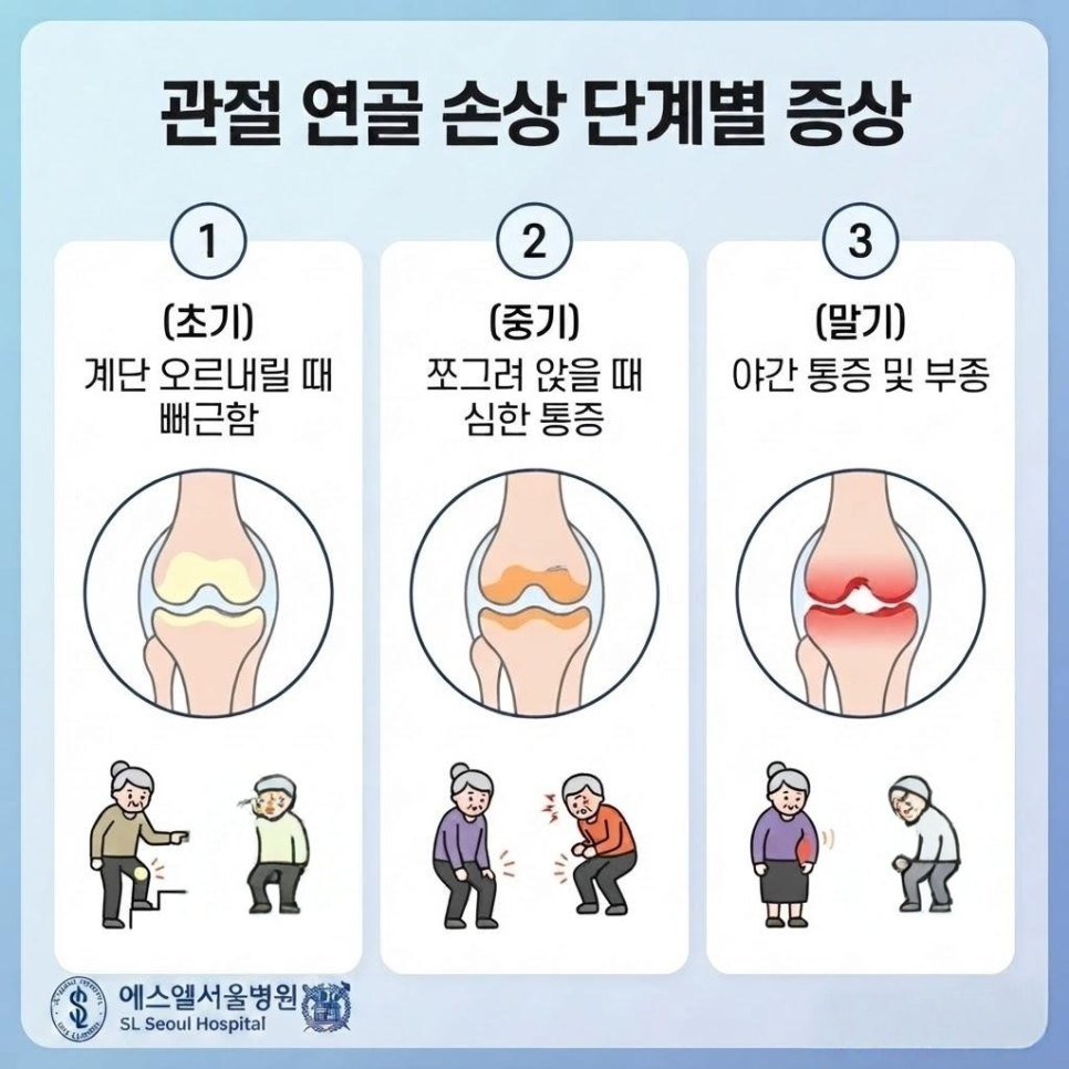 무릎 통증 원인 관련 이미지 4