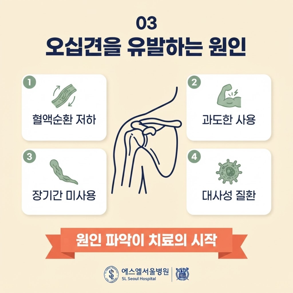 오십견치료 관련 이미지 7