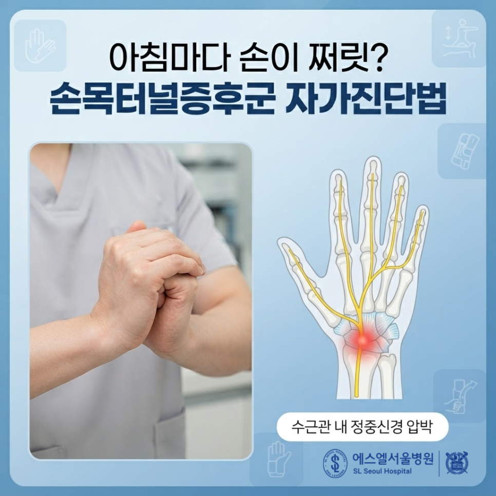 손목터널증후군 자가진단