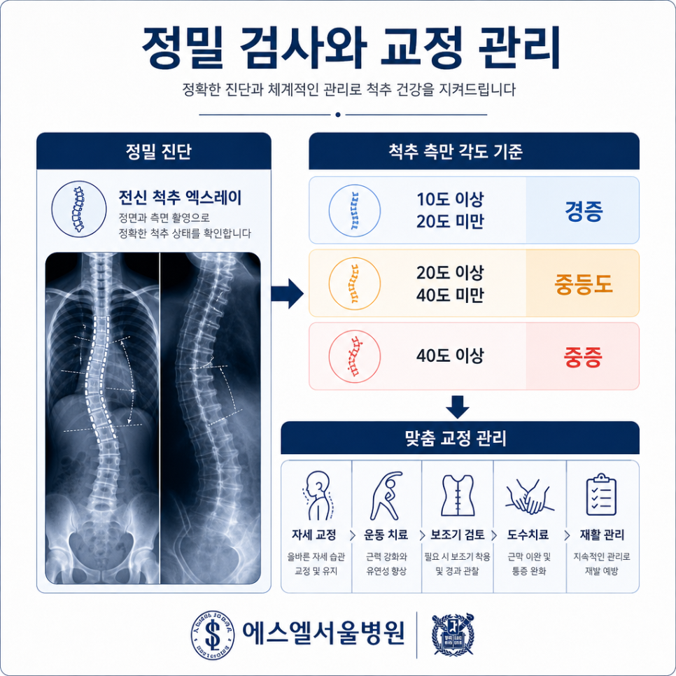 척추측만증 자가진단 관련 이미지 7